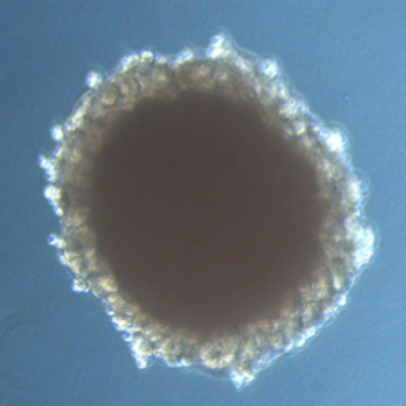 Un organoide renal generado a partir de células madre pluripotentes humanas. Foto: IBC